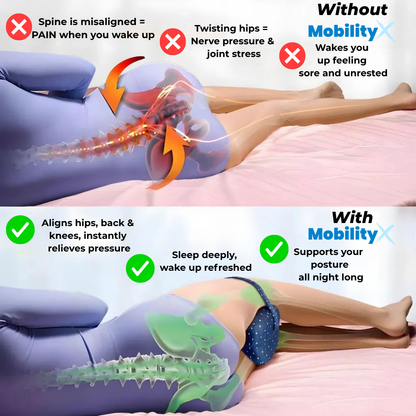 MobilityX - Alignment Pillow